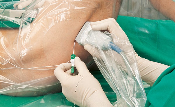 Pain therapy in orthopaedic and trauma surgery 