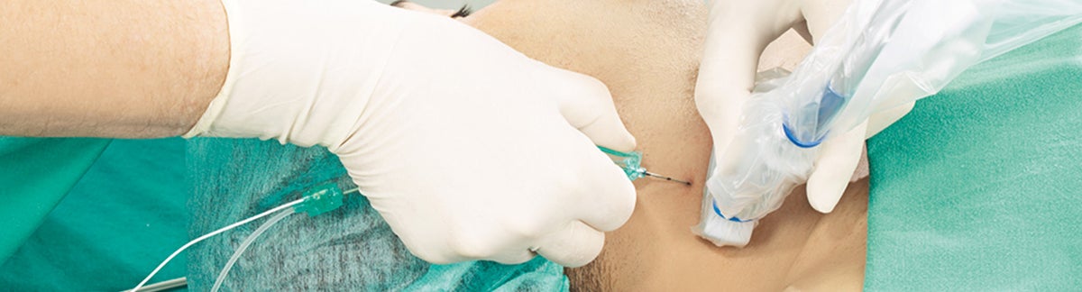 Learn about B. Braun's products and therapies in the field of pain therapy.
