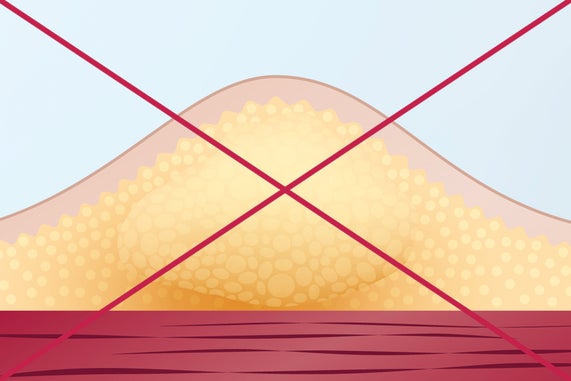 Site rotation - don't